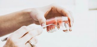 Mi a fogászati implantátumok szerepe?